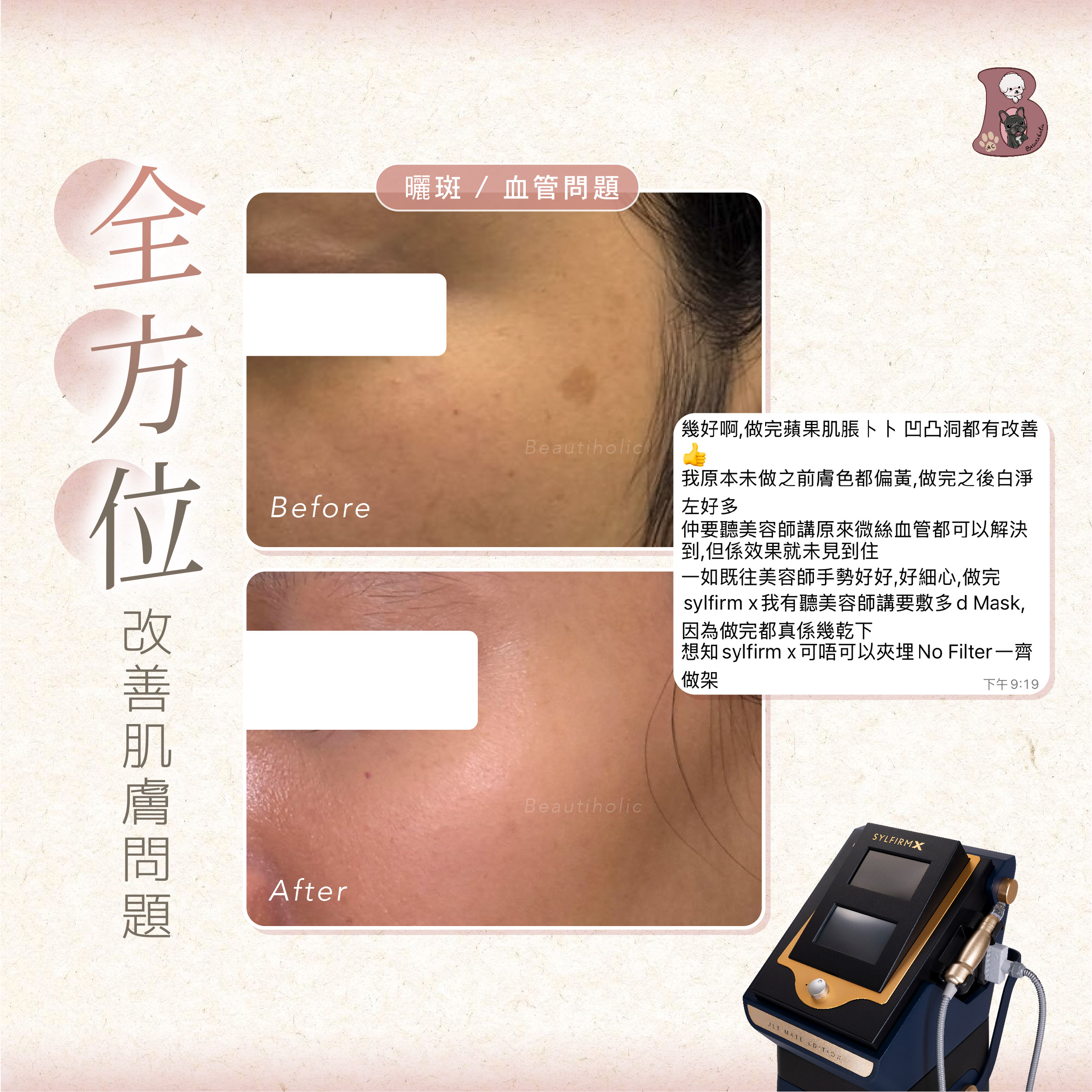 SYLFIRM X 黃金微針射頻 客戶見證 療程介紹 1