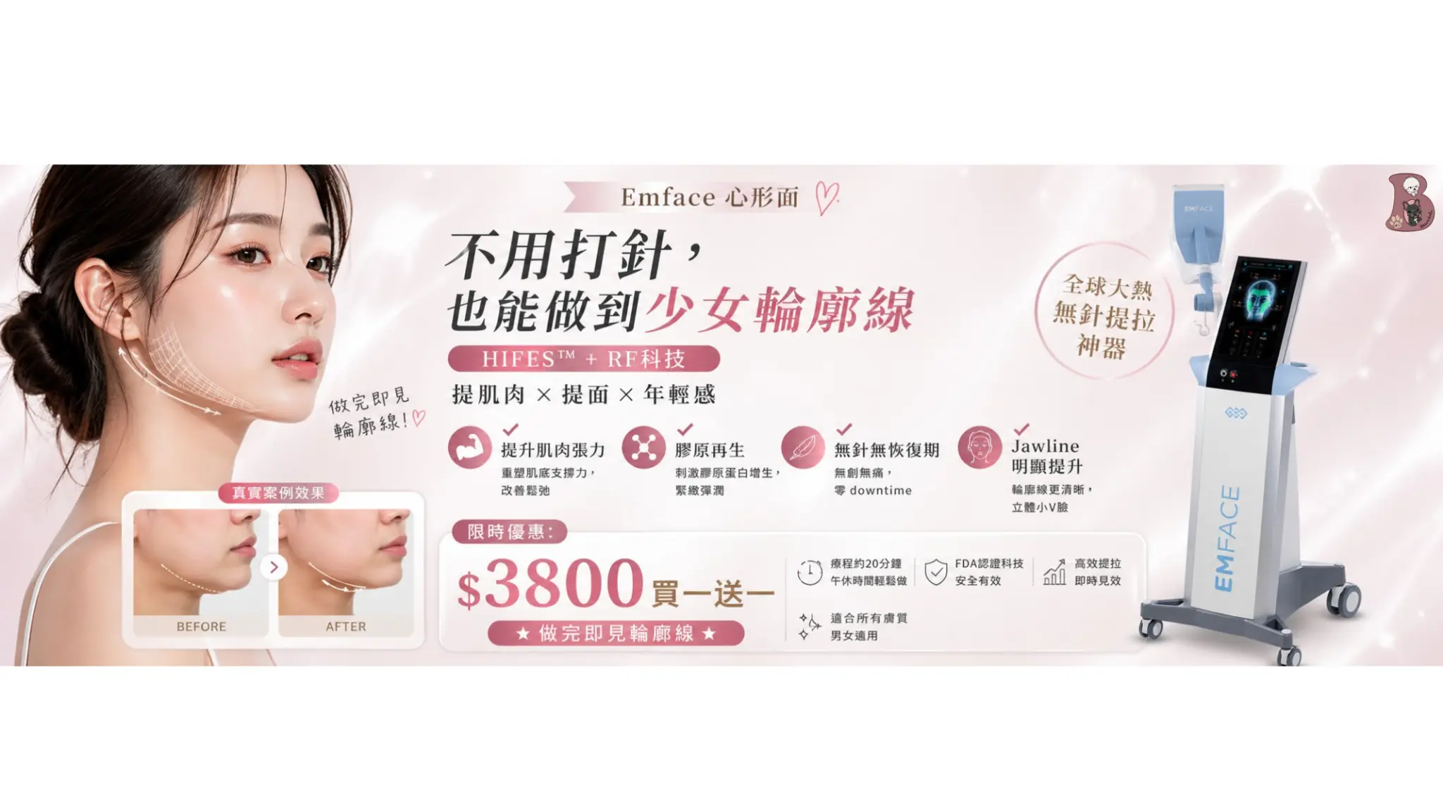 Emface