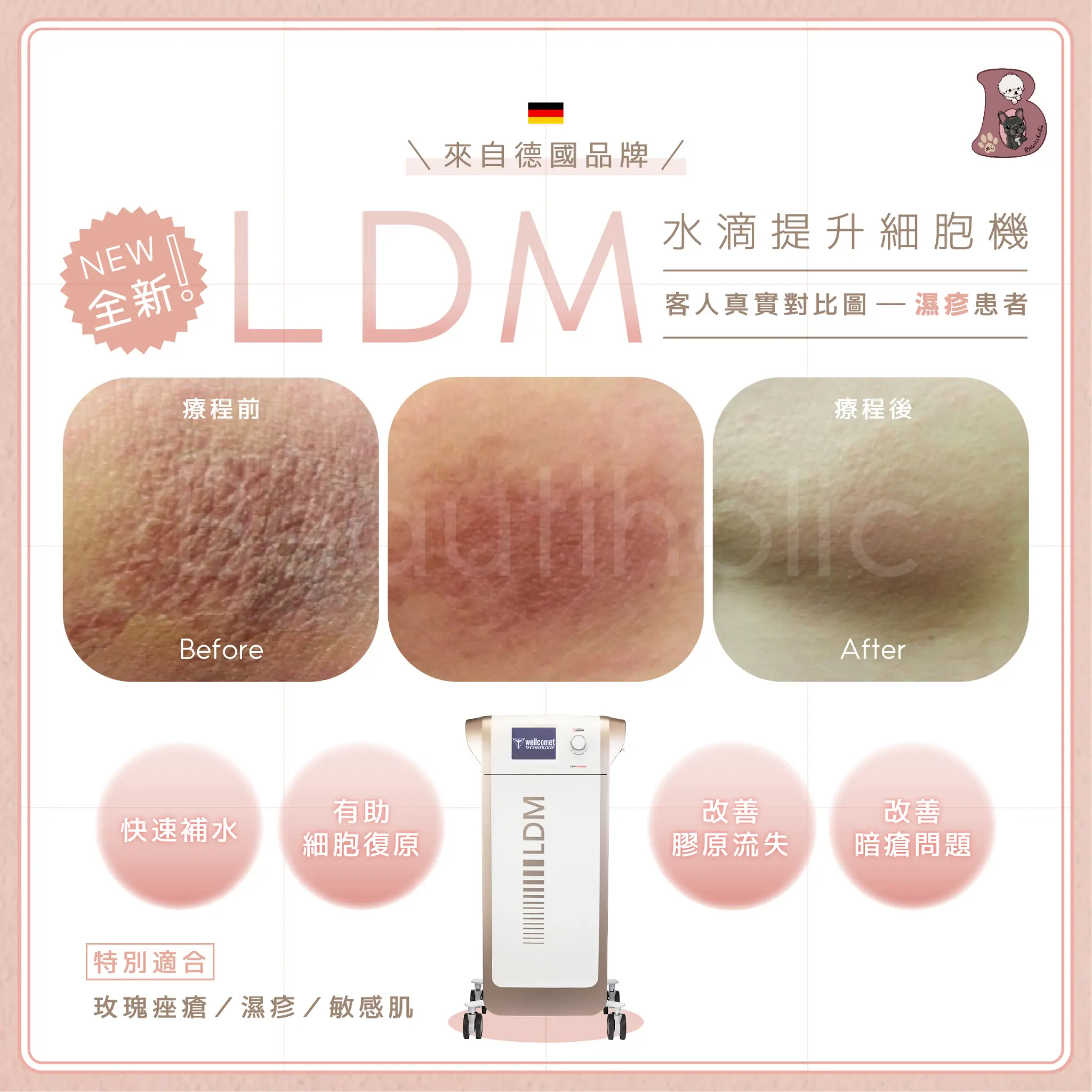 LDM水滴細胞再生 客戶見證 療程介紹 1