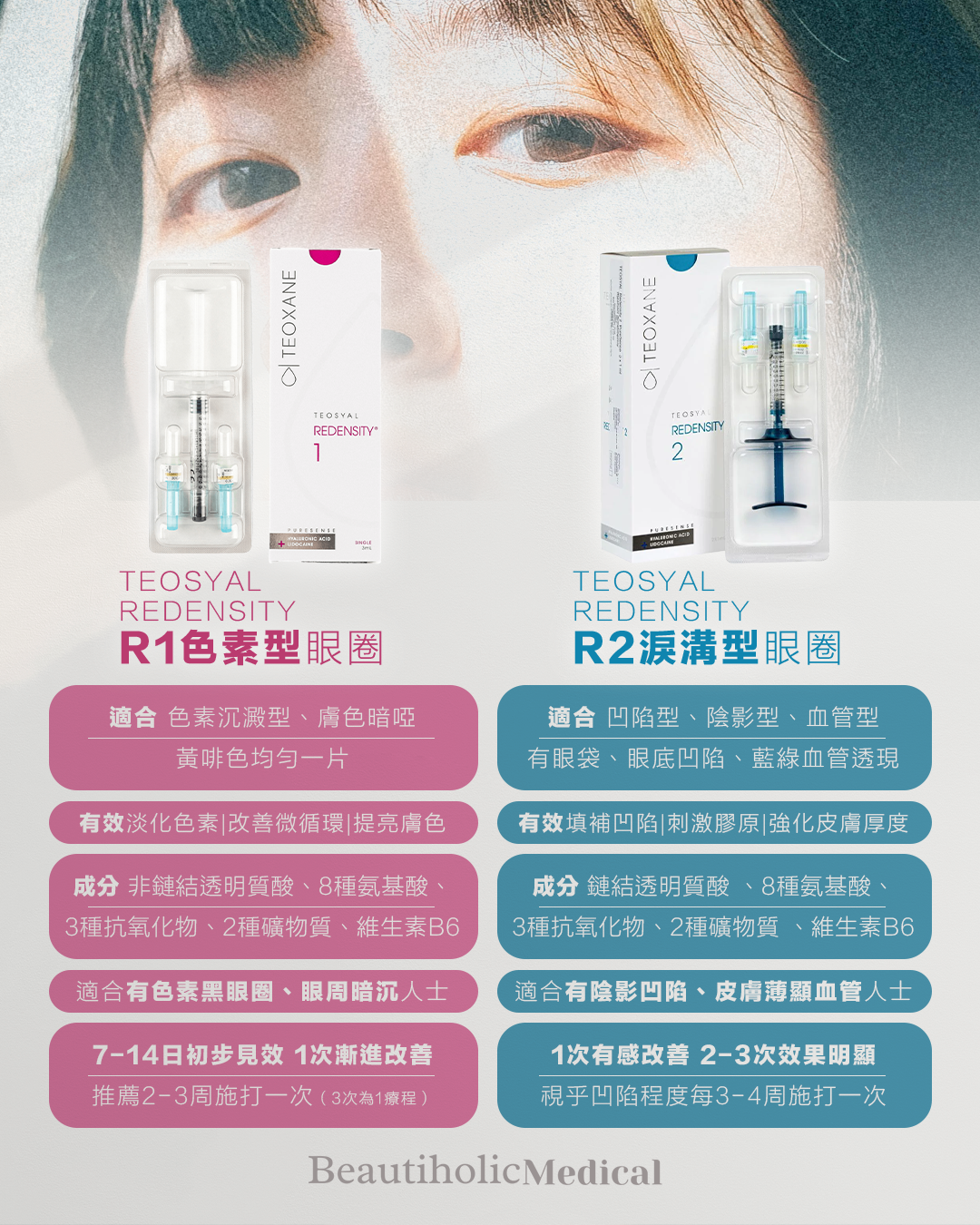 R1 vs R2 比較