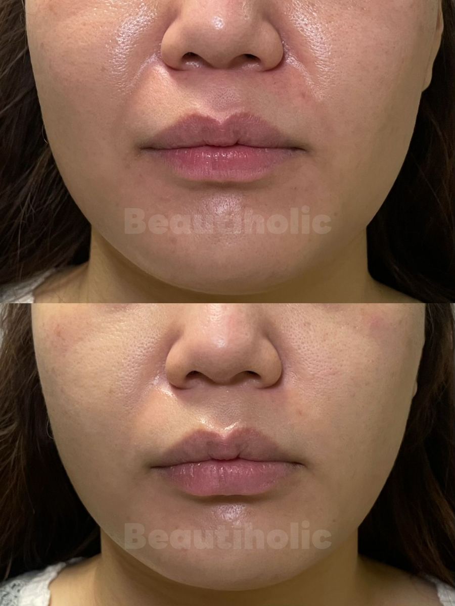 客戶見證 Before & After 1