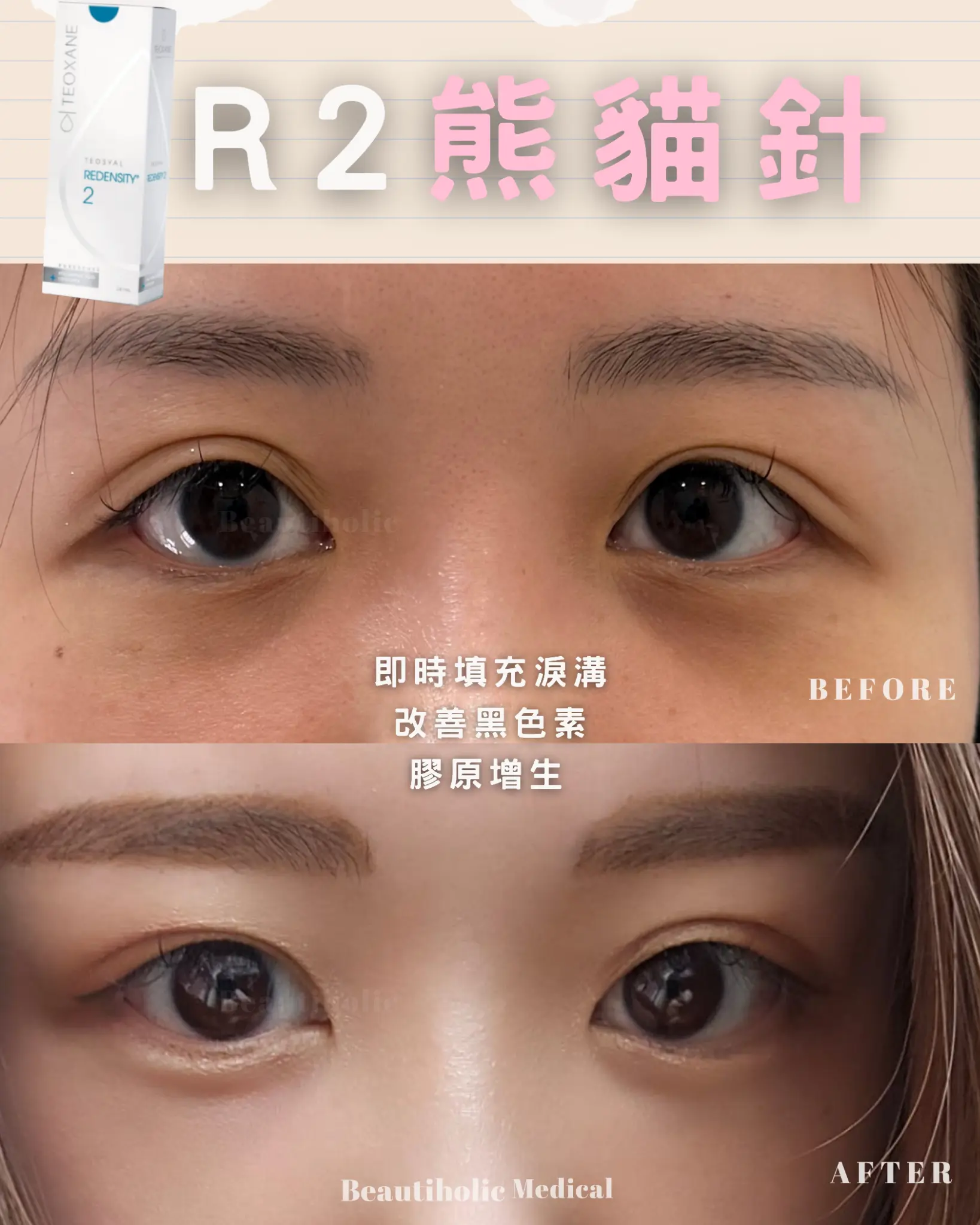 見證 1